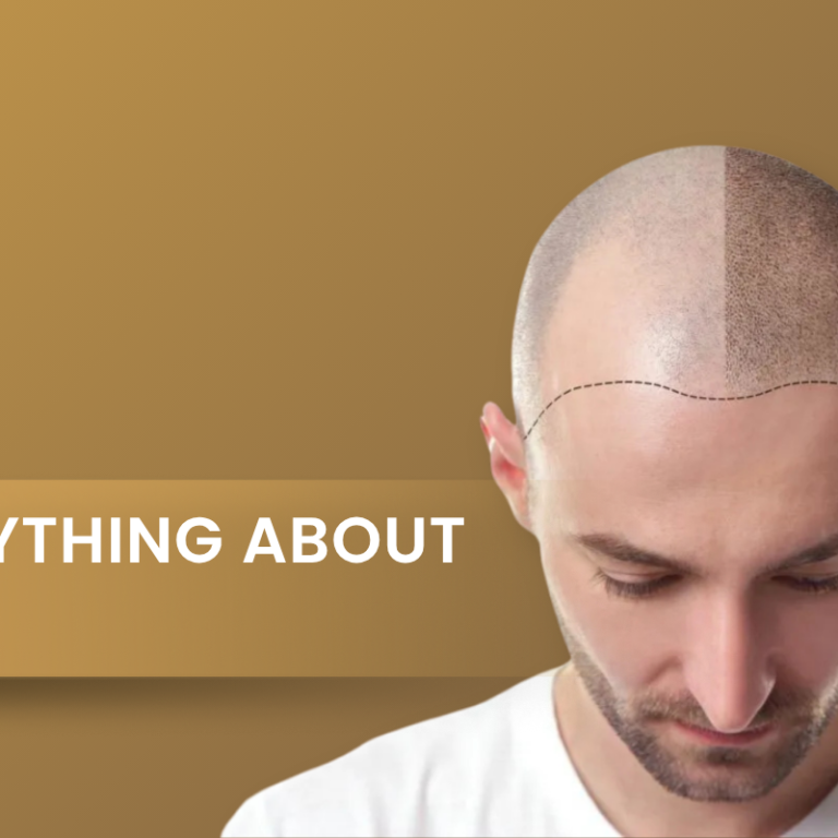 Everything About smp