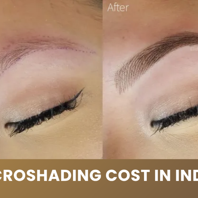 microshading cost in India